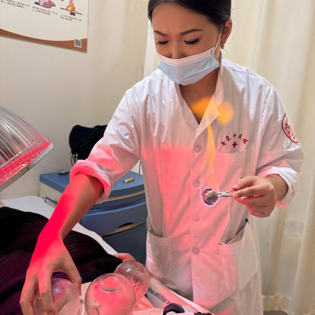 Cupping therapy treatment